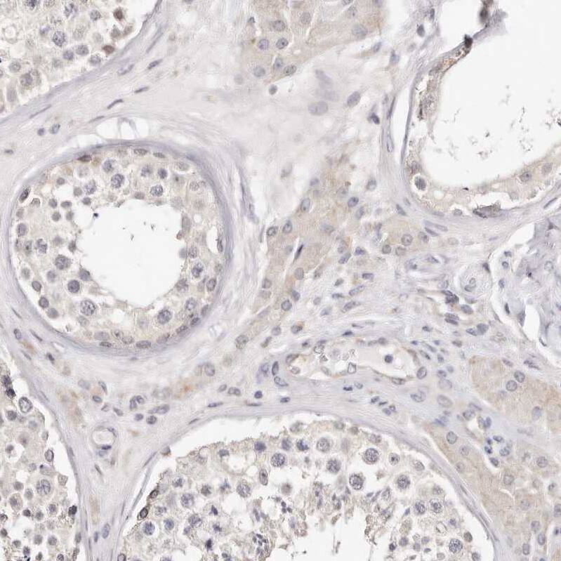 BCL2L15 Antibody - BSA Free Immunohistochemistry: BCL2L15 Antibody - BSA Free [NBP1-90767]