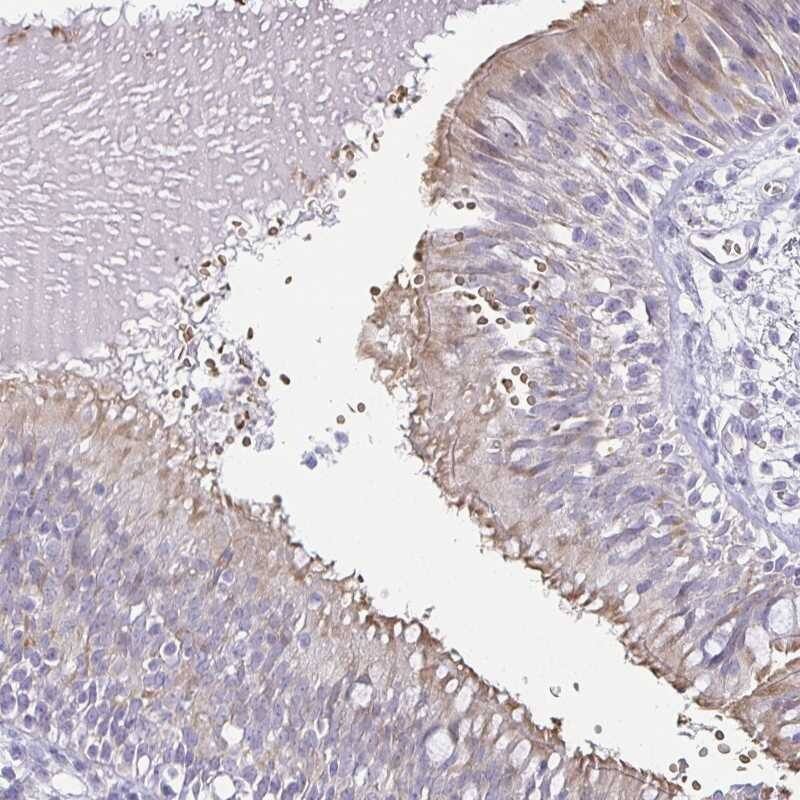 FAM162B Antibody - BSA Free Immunohistochemistry: FAM162B Antibody - BSA Free [NBP1-90775]