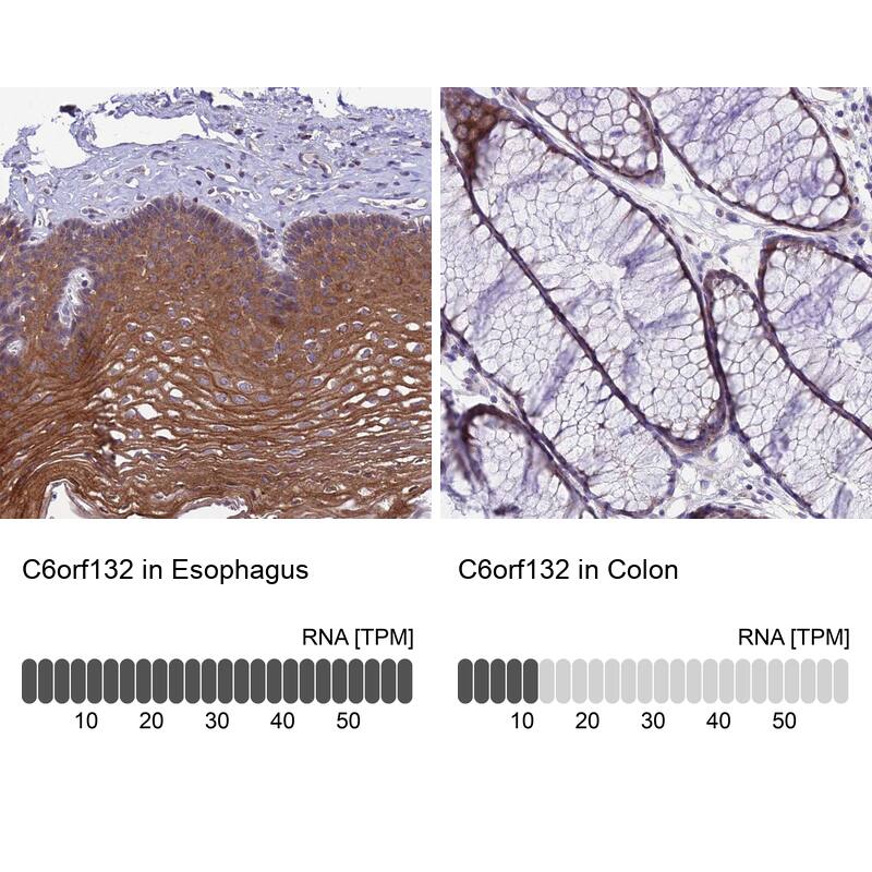 C6orf132 Antibody - BSA Free Immunohistochemistry: C6orf132 Antibody - BSA Free [NBP1-90776]