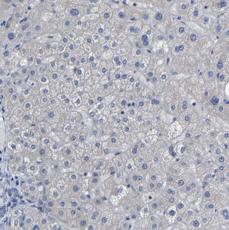 TBC1D32 Antibody - BSA Free Immunohistochemistry: TBC1D32 Antibody - BSA Free [NBP1-90777]