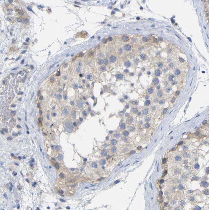 TBC1D32 Antibody - BSA Free Immunohistochemistry: TBC1D32 Antibody - BSA Free [NBP1-90777]