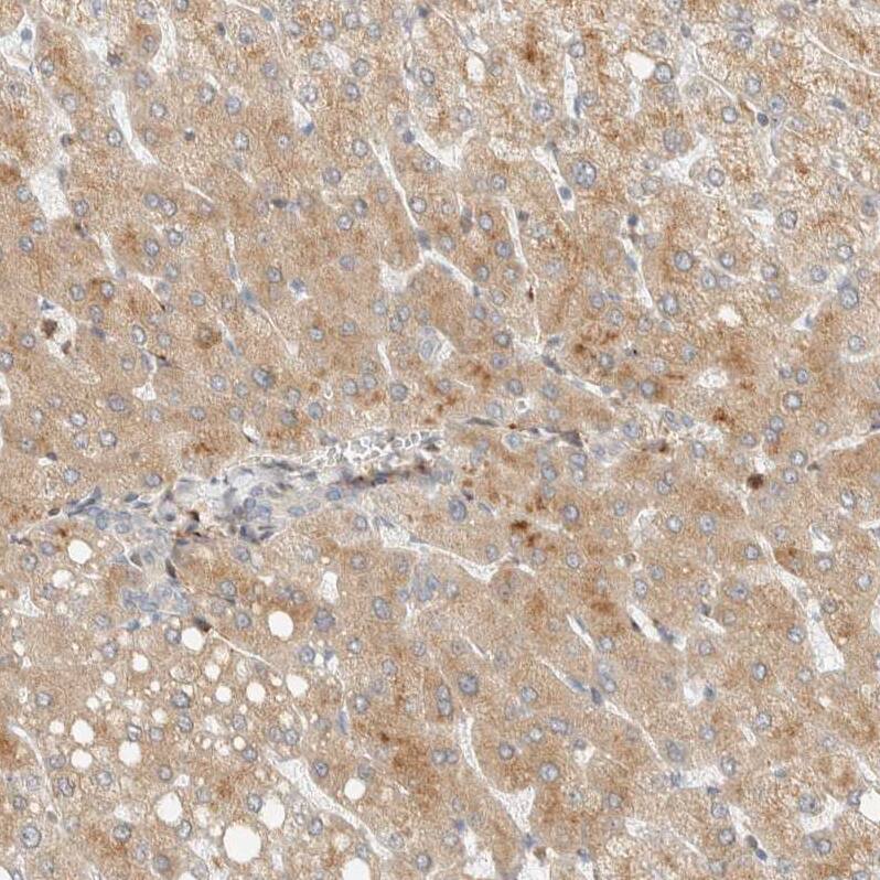CCDC171 Antibody - BSA Free Immunohistochemistry: CCDC171 Antibody - BSA Free [NBP1-90784]