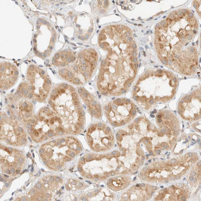 CCDC171 Antibody - BSA Free Immunohistochemistry: CCDC171 Antibody - BSA Free [NBP1-90784]