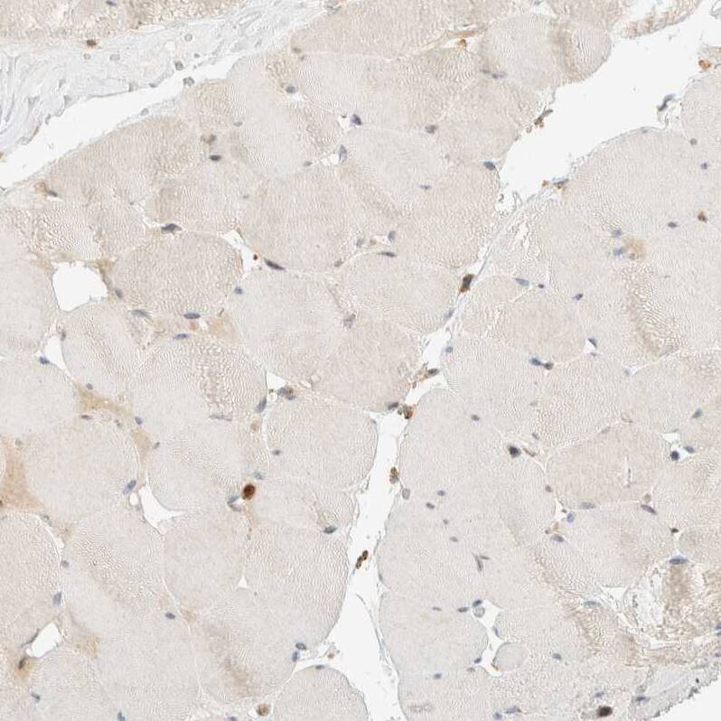 CCDC171 Antibody - BSA Free Immunohistochemistry: CCDC171 Antibody - BSA Free [NBP1-90784]
