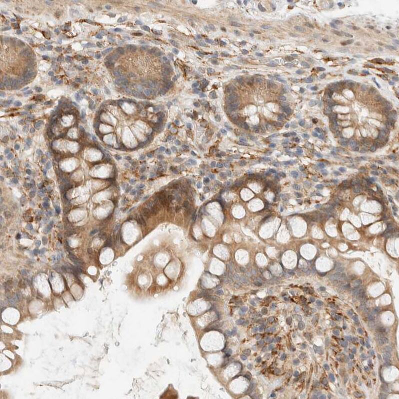 CCDC171 Antibody - BSA Free Immunohistochemistry: CCDC171 Antibody - BSA Free [NBP1-90784]
