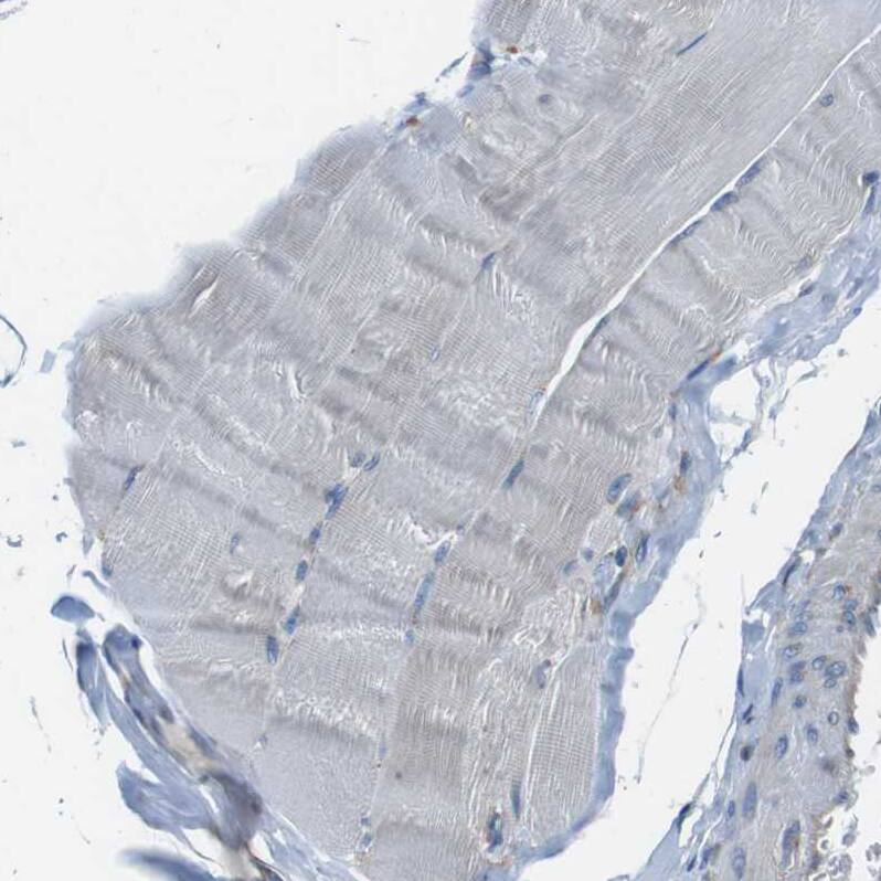 DENND4C Antibody - BSA Free Immunohistochemistry: DENND4C Antibody - BSA Free [NBP1-90788]