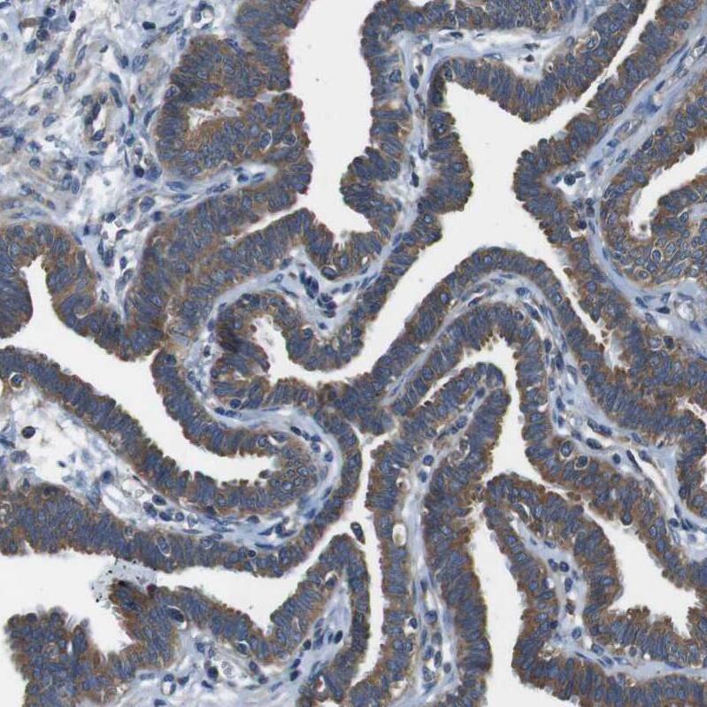 DENND4C Antibody - BSA Free Immunohistochemistry: DENND4C Antibody - BSA Free [NBP1-90788]