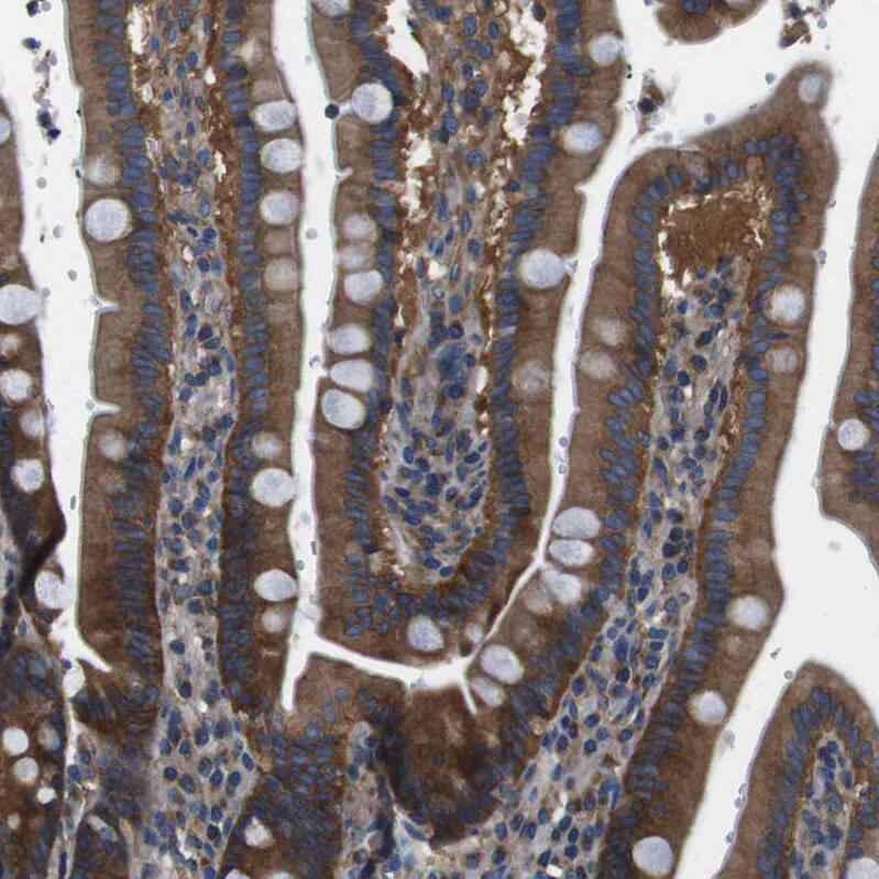 DENND4C Antibody - BSA Free Immunohistochemistry: DENND4C Antibody - BSA Free [NBP1-90788]