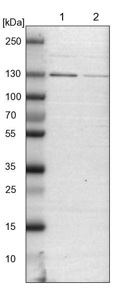 DENND4C Antibody - BSA Free Western Blot: DENND4C Antibody - BSA Free [NBP1-90788]