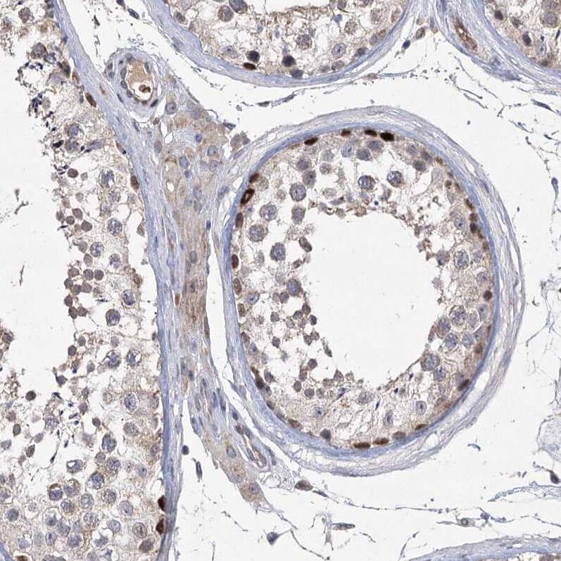 NSMCE4A Antibody - BSA Free Immunohistochemistry: NSMCE4A Antibody - BSA Free [NBP1-90789]