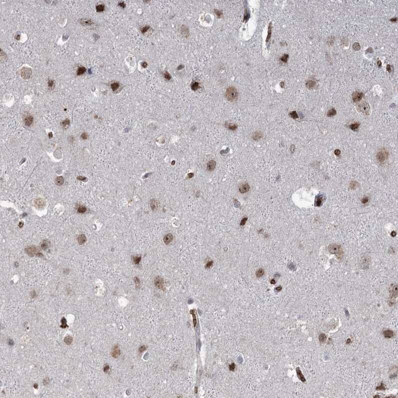 NSMCE4A Antibody - BSA Free Immunohistochemistry: NSMCE4A Antibody - BSA Free [NBP1-90789]