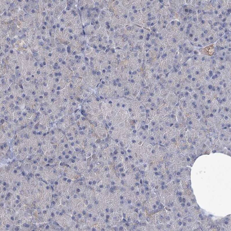 NSMCE4A Antibody - BSA Free Immunohistochemistry: NSMCE4A Antibody - BSA Free [NBP1-90789]