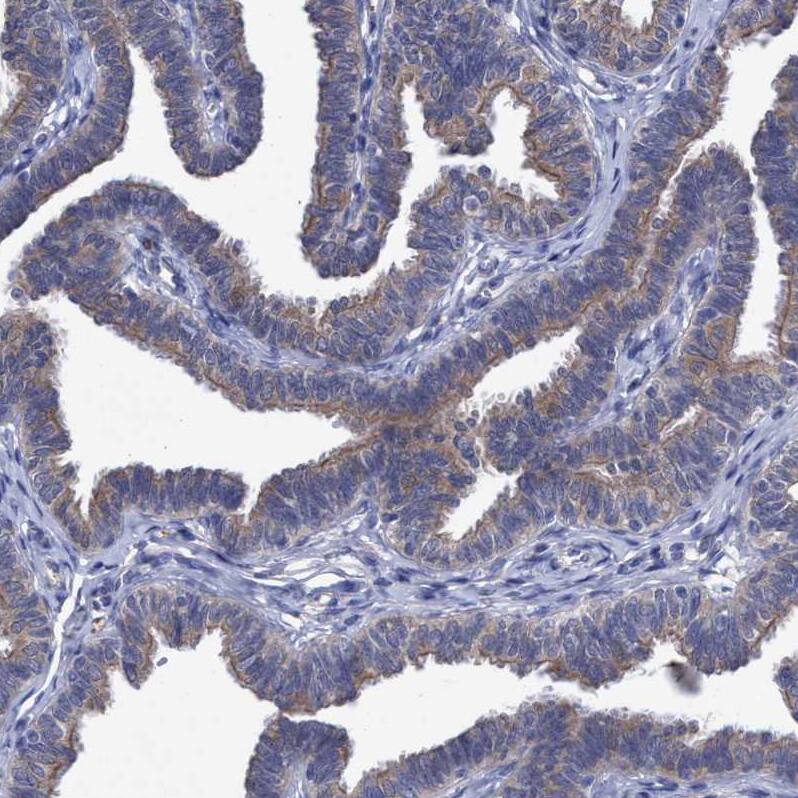 SVEP1 Antibody - BSA Free Immunohistochemistry: SVEP1 Antibody - BSA Free [NBP1-90791]