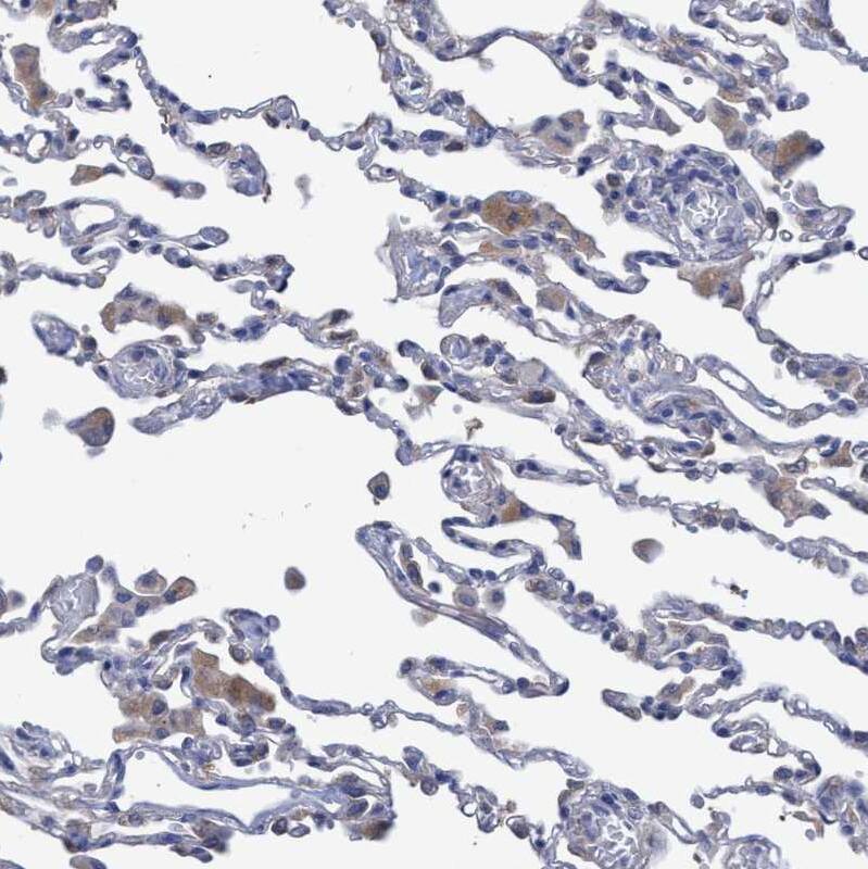 SVEP1 Antibody - BSA Free Immunohistochemistry: SVEP1 Antibody - BSA Free [NBP1-90791]