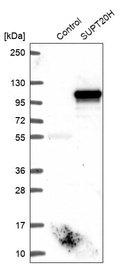 FAM48A Antibody - BSA Free Western Blot: FAM48A Antibody - BSA Free [NBP1-90794]
