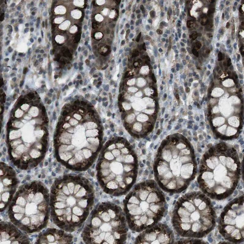 SLITRK5 Antibody - BSA Free Immunohistochemistry: SLITRK5 Antibody - BSA Free [NBP1-90798]