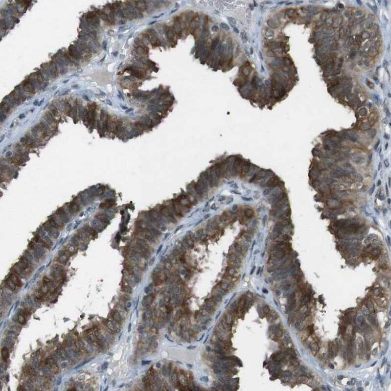 SLITRK5 Antibody - BSA Free Immunohistochemistry: SLITRK5 Antibody - BSA Free [NBP1-90798]