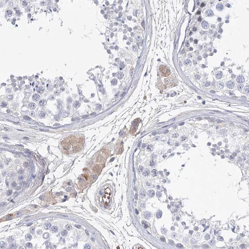 FAM208B Antibody - BSA Free Immunohistochemistry: FAM208B Antibody - BSA Free [NBP1-90803]