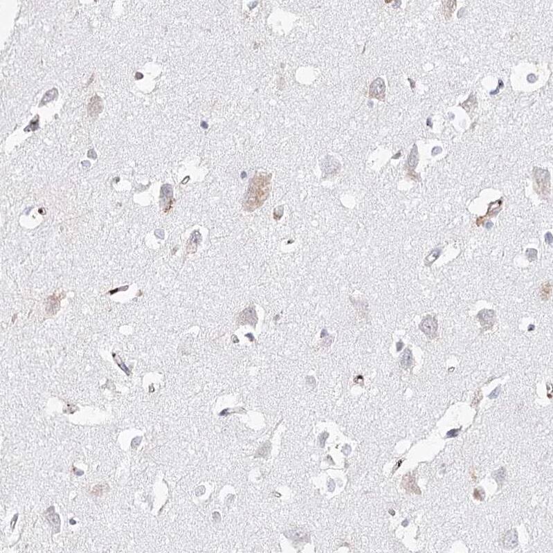 FAM208B Antibody - BSA Free Immunohistochemistry: FAM208B Antibody - BSA Free [NBP1-90803]