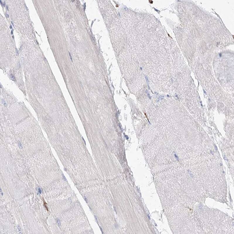 FAM208B Antibody - BSA Free Immunohistochemistry: FAM208B Antibody - BSA Free [NBP1-90803]