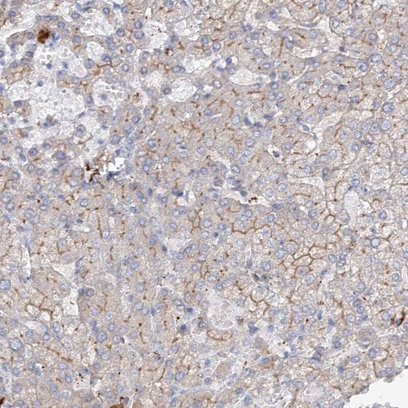 FAM208B Antibody - BSA Free Immunohistochemistry: FAM208B Antibody - BSA Free [NBP1-90803]