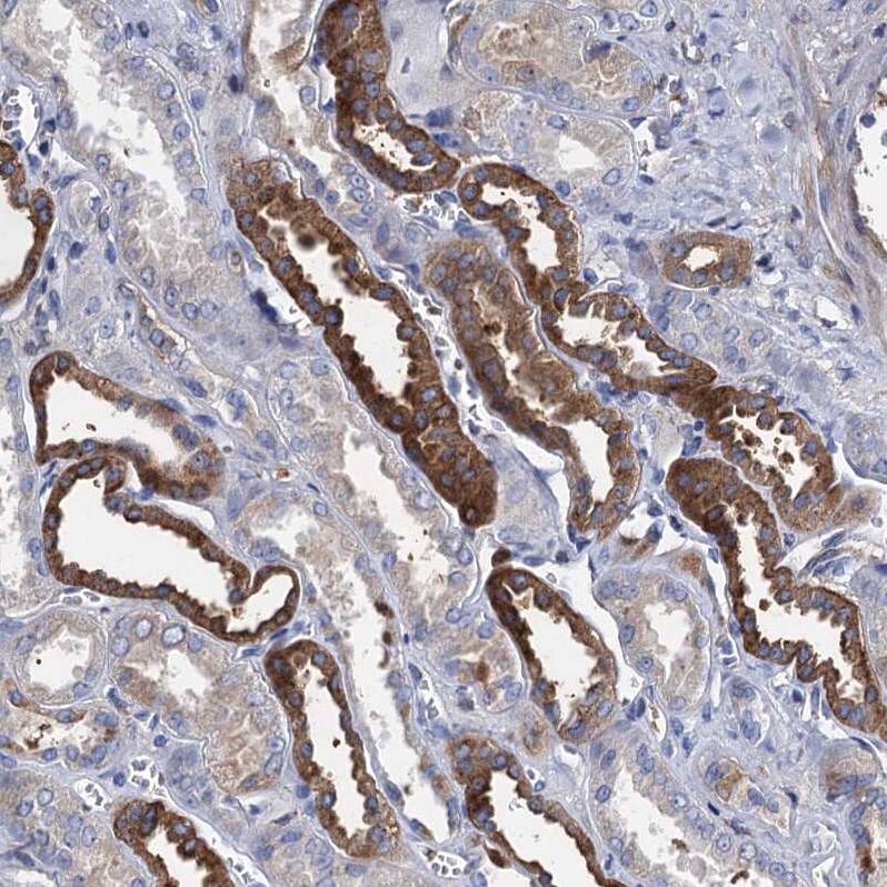 TMEM72 Antibody - BSA Free Immunohistochemistry: TMEM72 Antibody - BSA Free [NBP1-90808]