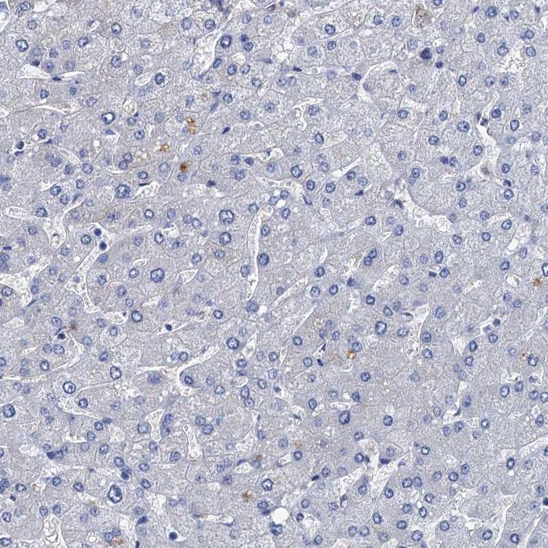 TMEM72 Antibody - BSA Free Immunohistochemistry: TMEM72 Antibody - BSA Free [NBP1-90808]