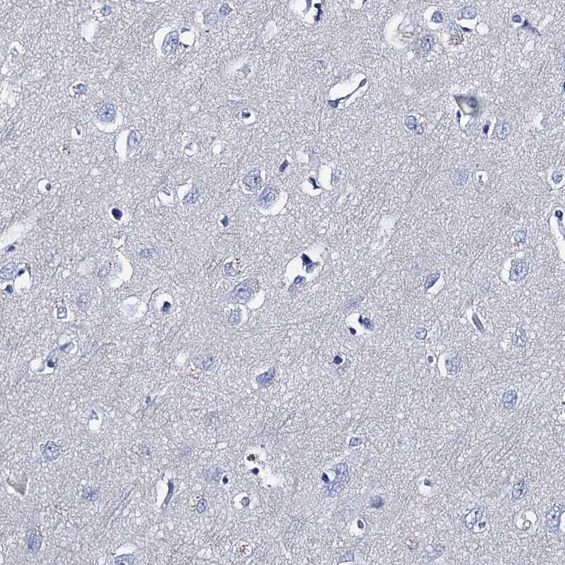 TMEM72 Antibody - BSA Free Immunohistochemistry: TMEM72 Antibody - BSA Free [NBP1-90808]