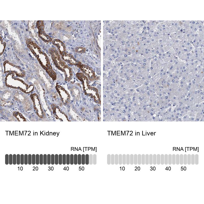TMEM72 Antibody - BSA Free Immunohistochemistry: TMEM72 Antibody - BSA Free [NBP1-90808]