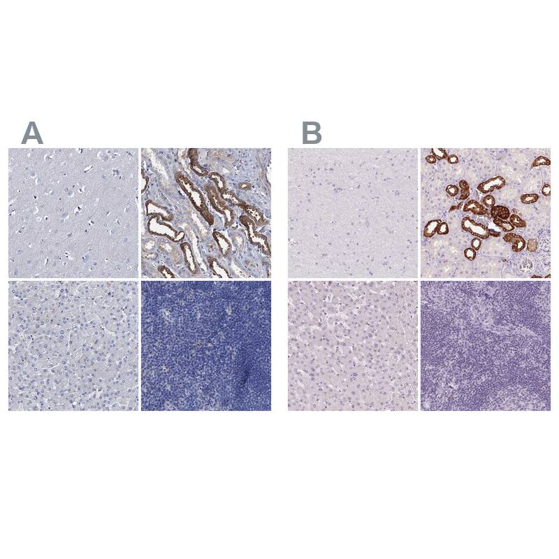 TMEM72 Antibody - BSA Free Immunohistochemistry: TMEM72 Antibody - BSA Free [NBP1-90808]