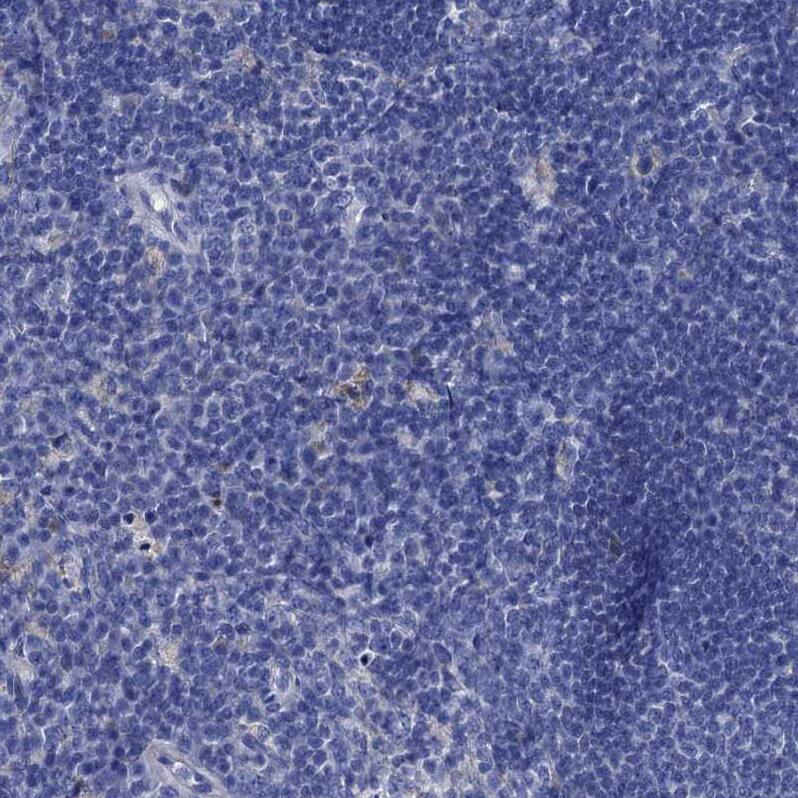 TMEM72 Antibody - BSA Free Immunohistochemistry: TMEM72 Antibody - BSA Free [NBP1-90808]