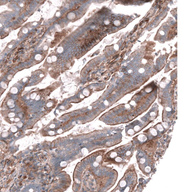 NKAIN4 Antibody - BSA Free Immunohistochemistry: NKAIN4 Antibody - BSA Free [NBP1-90809]