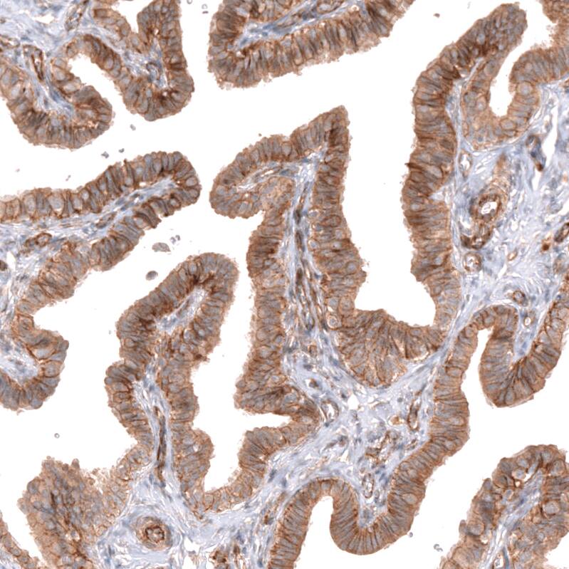NKAIN4 Antibody - BSA Free Immunohistochemistry: NKAIN4 Antibody - BSA Free [NBP1-90809]