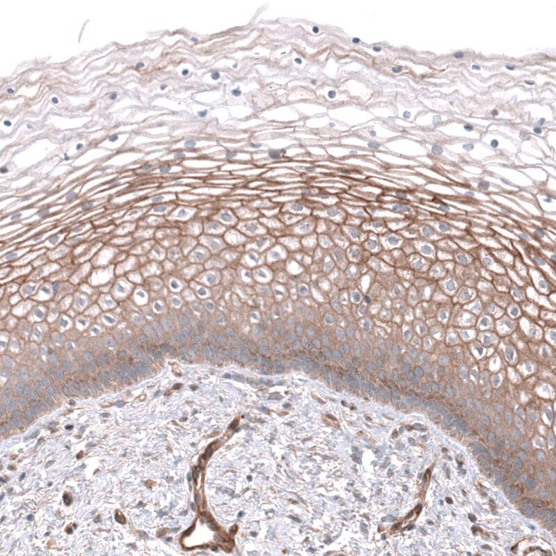 NKAIN4 Antibody - BSA Free Immunohistochemistry: NKAIN4 Antibody - BSA Free [NBP1-90809]