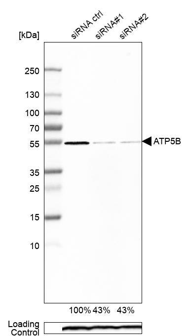ATPB Antibody - BSA Free Western Blot: ATPB Antibody - BSA Free [NBP1-90815]