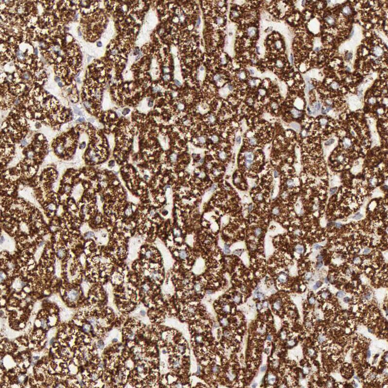 ATPB Antibody - BSA Free Immunohistochemistry: ATPB Antibody - BSA Free [NBP1-90815]