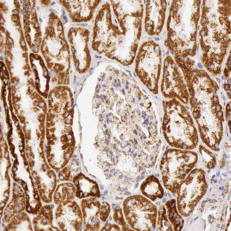 ATPB Antibody - BSA Free Immunohistochemistry: ATPB Antibody - BSA Free [NBP1-90816]