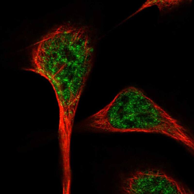 RBM27 Antibody - BSA Free Immunocytochemistry/ Immunofluorescence: RBM27 Antibody [NBP1-90817]