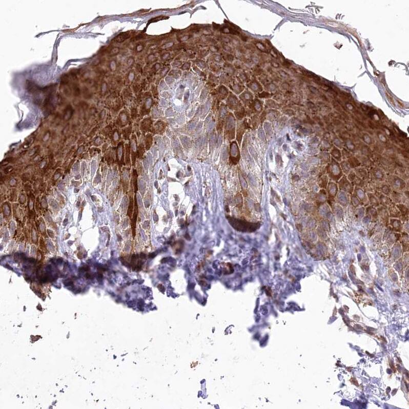 RBM27 Antibody - BSA Free Immunohistochemistry: RBM27 Antibody - BSA Free [NBP1-90818]