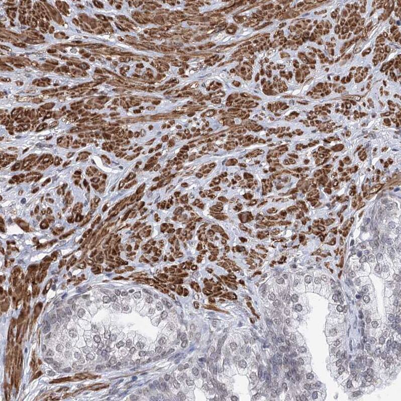 RBM27 Antibody - BSA Free Immunohistochemistry: RBM27 Antibody - BSA Free [NBP1-90818]