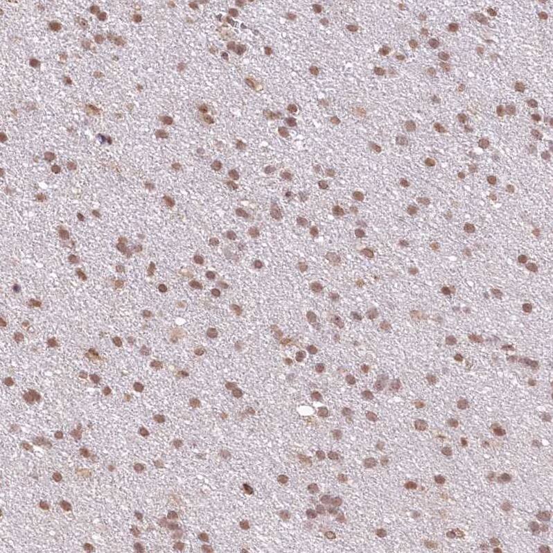 RBM27 Antibody - BSA Free Immunohistochemistry: RBM27 Antibody - BSA Free [NBP1-90818]