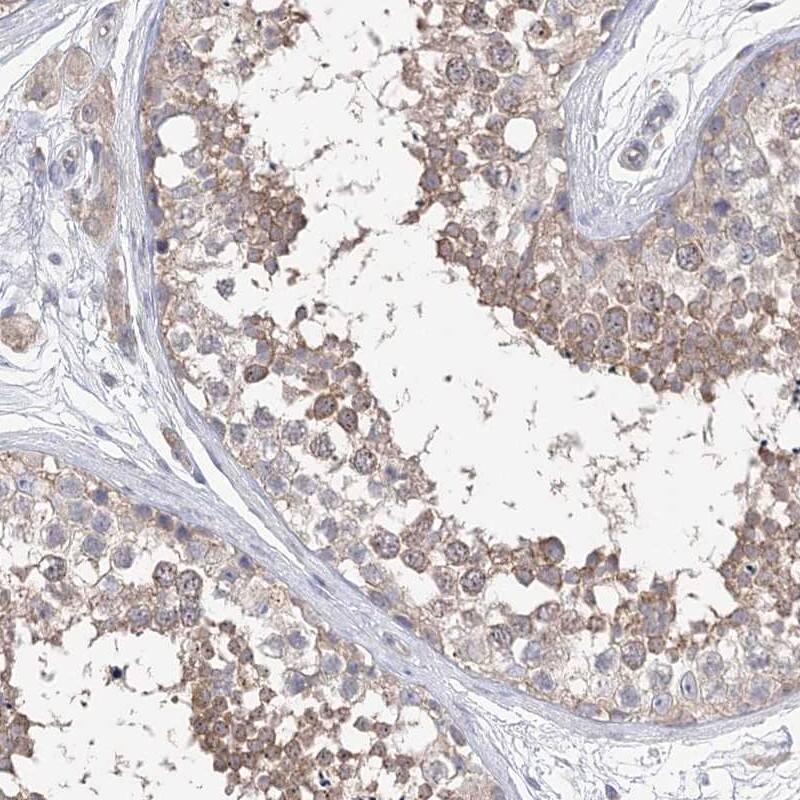 Aurora C Antibody - BSA Free Immunohistochemistry: Aurora C Antibody - BSA Free [NBP1-90819]