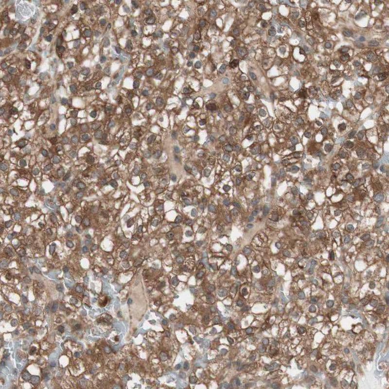 Renin R Antibody - BSA Free Immunohistochemistry: Renin R Antibody - BSA Free [NBP1-90820]