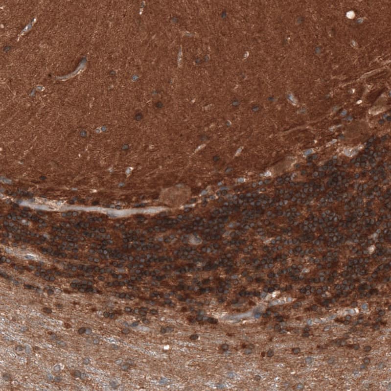 Renin R Antibody - BSA Free Immunohistochemistry: Renin R Antibody - BSA Free [NBP1-90820]