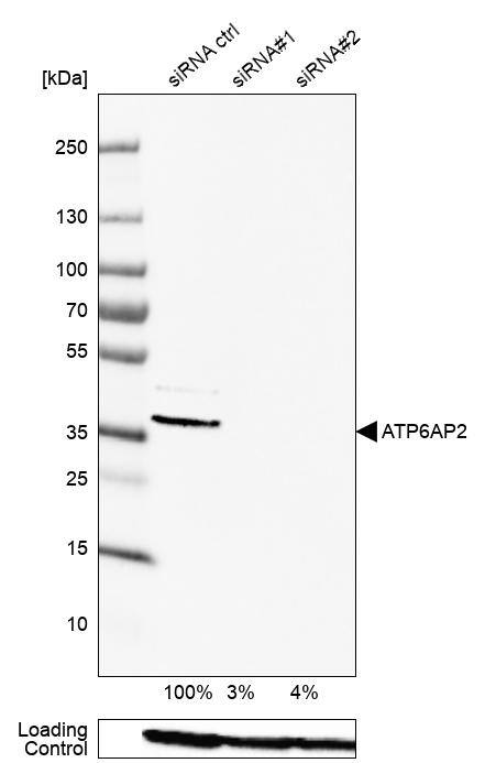 Renin R Antibody - BSA Free Western Blot: Renin R Antibody - BSA Free [NBP1-90820]