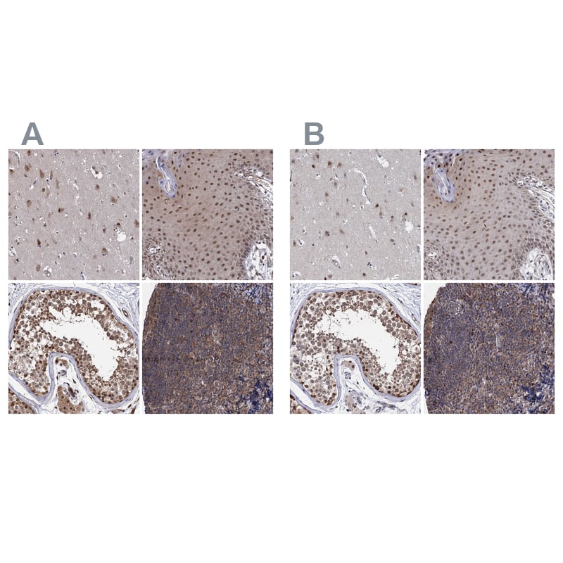 S5a/Angiocidin Antibody - BSA Free Immunohistochemistry: S5a/Angiocidin Antibody - BSA Free [NBP1-90821]