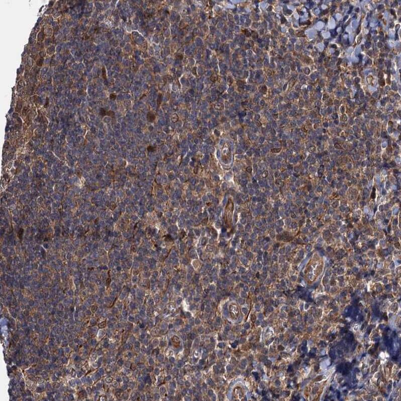 S5a/Angiocidin Antibody - BSA Free Immunohistochemistry: S5a/Angiocidin Antibody - BSA Free [NBP1-90821]