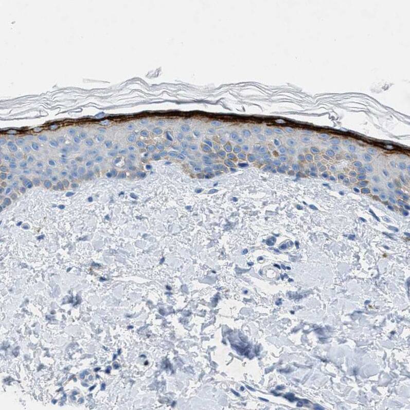 TMEM180 Antibody - BSA Free Immunohistochemistry: TMEM180 Antibody - BSA Free [NBP1-90827]