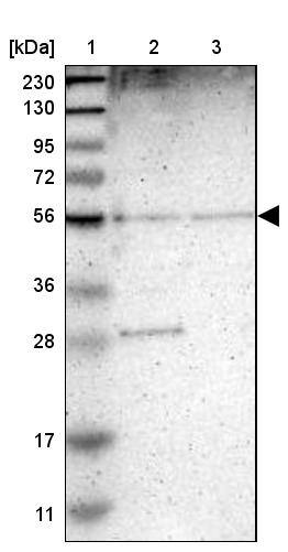 TMEM180 Antibody - BSA Free Western Blot: TMEM180 Antibody - BSA Free [NBP1-90827]
