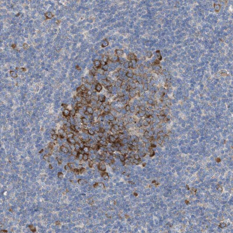 UBAP2 Antibody - BSA Free Immunohistochemistry: UBAP2 Antibody - BSA Free [NBP1-90829]